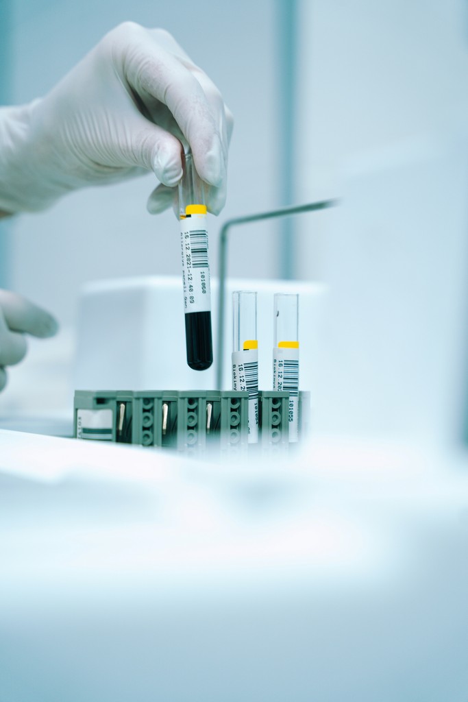 Laboratory blood sample handling